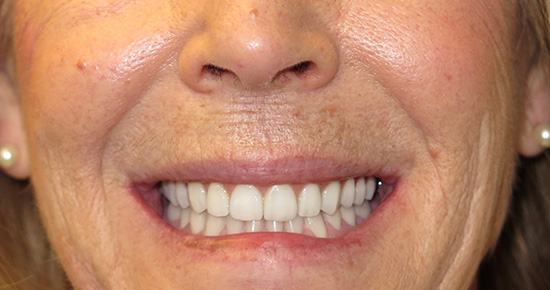 Above   Beyond Dentistry   Implants | Crowns  amp  Caps, Periodontal Treatment and TMJ Disorders