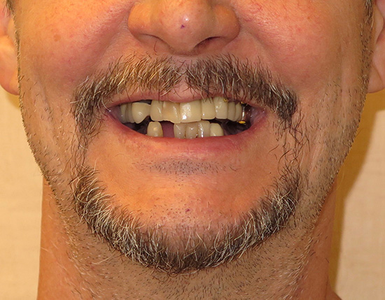 Above   Beyond Dentistry   Implants | E4D, Orthodontics and All-on-6