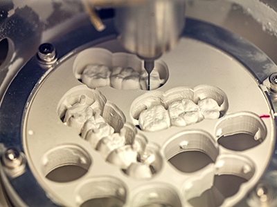 Above   Beyond Dentistry   Implants