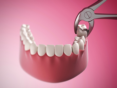 Above Beyond Dentistry Implants