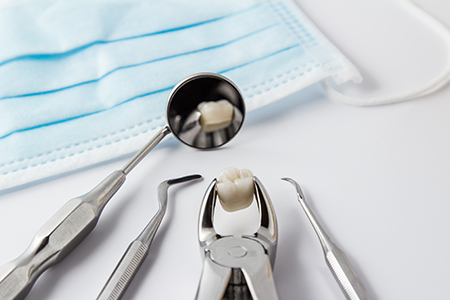 Above Beyond Dentistry Implants