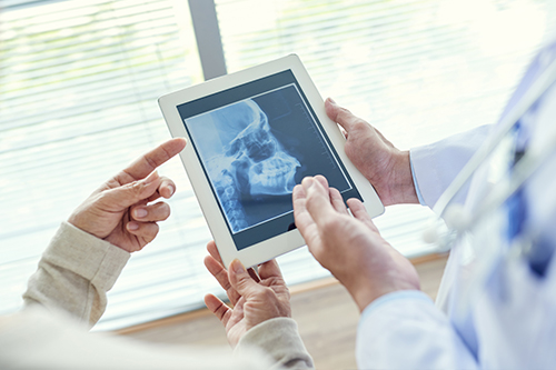 Above   Beyond Dentistry   Implants
