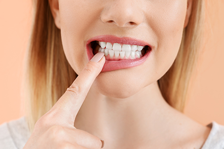 Above Beyond Dentistry Implants
