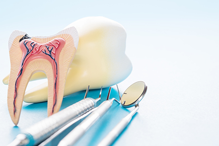 Above Beyond Dentistry Implants