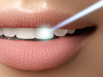 Above   Beyond Dentistry   Implants